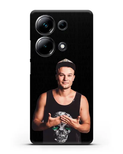 Чехол с фотографией Макс Корж и надписью Небо поможем нам! силиконовый для Xiaomi Poco M6 Pro