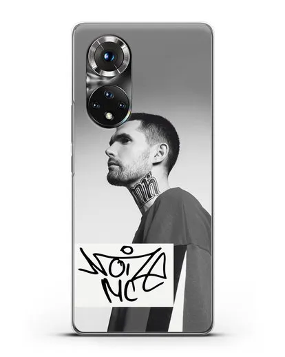 Чехол с фотографией Noize MC силиконовый для Honor 50