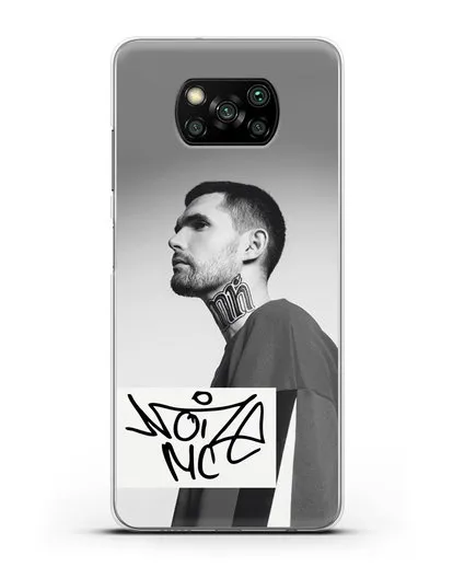 Чехол с фотографией Noize MC силиконовый для Xiaomi Poco X3 Pro
