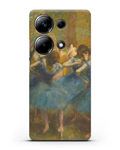 Чехол Танцовщицы в синем (Эдгар Дега) силиконовый для Xiaomi Poco M6 Pro