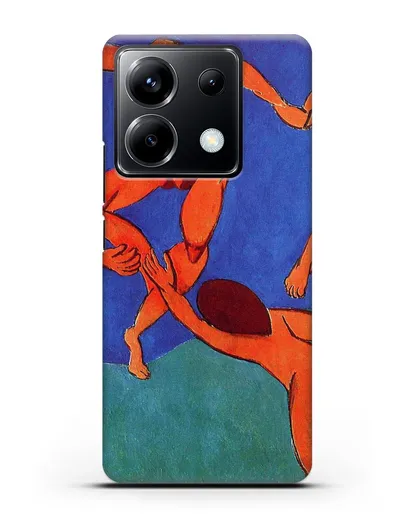 Чехол Танец (Матисс Анри) силиконовый для Xiaomi Poco X6