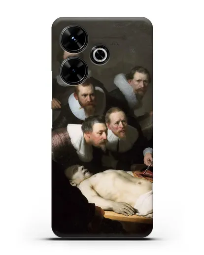 Чехол Урок анатомии доктора Николаса Тюльпа (Рембрандт Харменс ван Рейн) силиконовый для Xiaomi Poco M6