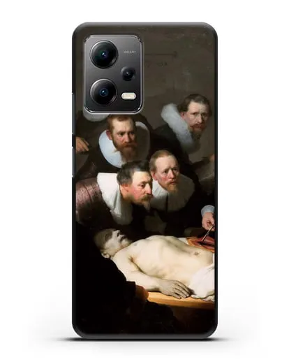 Чехол Урок анатомии доктора Николаса Тюльпа (Рембрандт Харменс ван Рейн) силиконовый для Xiaomi Poco X5