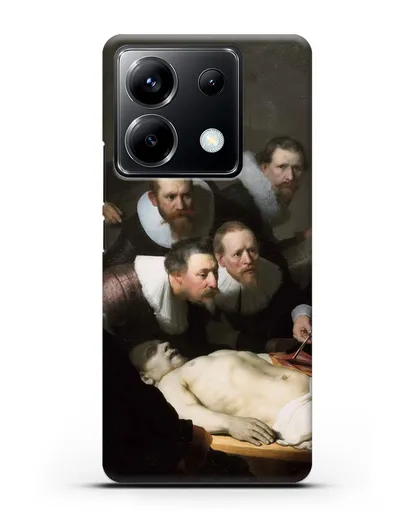 Чехол Урок анатомии доктора Николаса Тюльпа (Рембрандт Харменс ван Рейн) силиконовый для Xiaomi Poco X6