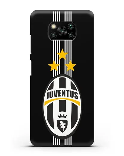 Чехол с логотипом Ювентус силиконовый для Xiaomi Poco X3 Pro