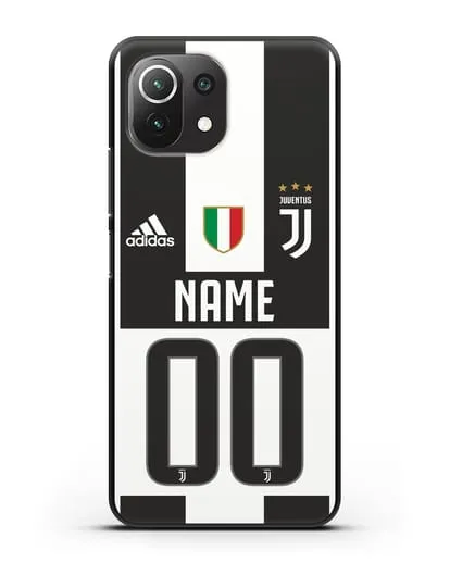 Именной чехол Ювентус с фамилией и номером (сезон 2018-2019) бело-черная форма силиконовый для Xiaomi 11 Lite