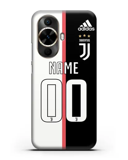 Именной чехол Ювентус с фамилией и номером (сезон 2019-2020) бело-черная форма силиконовый для Huawei Nova 12s