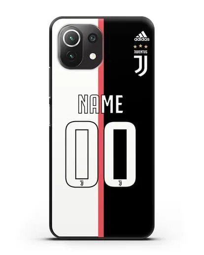 Именной чехол Ювентус с фамилией и номером (сезон 2019-2020) бело-черная форма силиконовый для Xiaomi 11 Lite