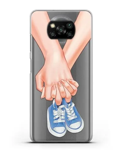 Чехол с иллюстрацией В ожидании малыша силиконовый для Xiaomi Poco X3