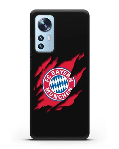 Чехол с эмблемой Бавария Мюнхен силиконовый для Xiaomi 12