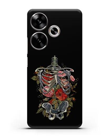 Чехол Скелет силиконовый для Xiaomi Poco F6