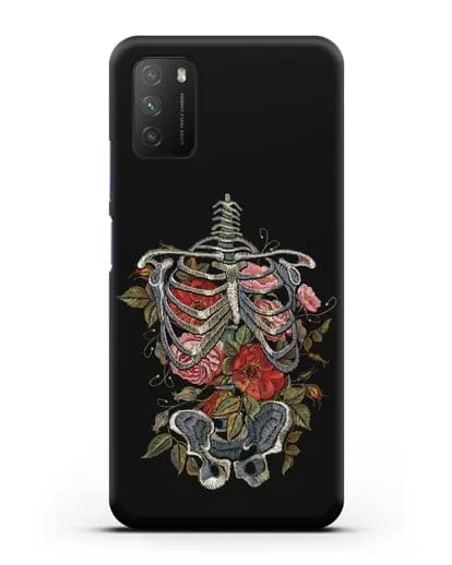 Чехол Скелет силиконовый для Xiaomi Poco M3