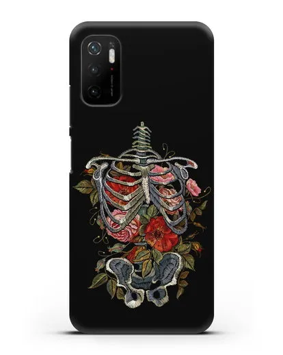 Чехол Скелет силиконовый для Xiaomi Poco M3 Pro