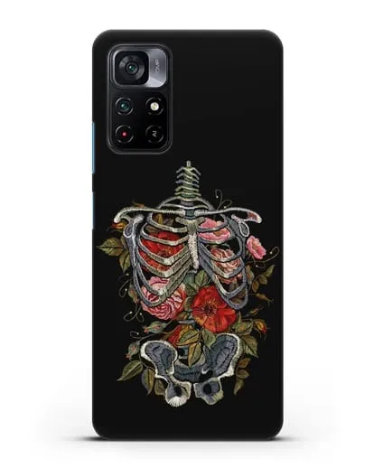 Чехол Скелет силиконовый для Xiaomi Poco M4 Pro 5G