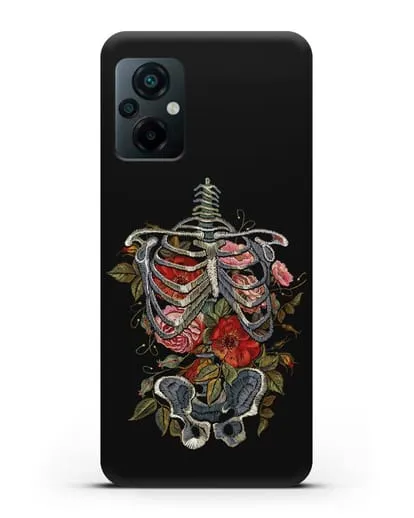 Чехол Скелет силиконовый для Xiaomi Poco M5