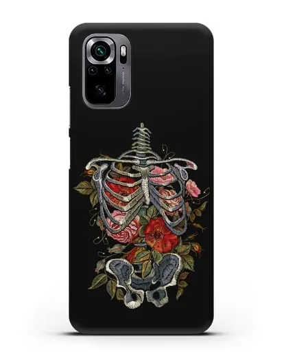 Чехол Скелет силиконовый для Xiaomi Poco M5s