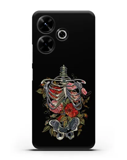 Чехол Скелет силиконовый для Xiaomi Poco M6