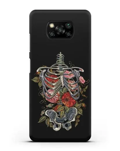 Чехол Скелет силиконовый для Xiaomi Poco X3