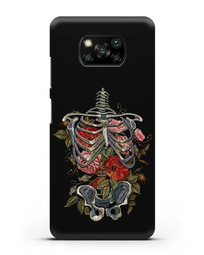 Чехол Скелет силиконовый для Xiaomi Poco X3 Pro