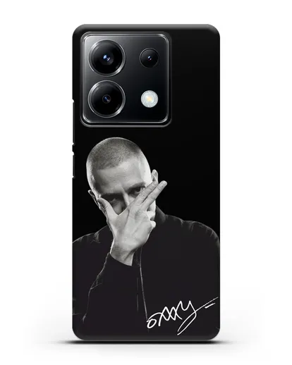 Чехол с фотографией Oxxxymiron силиконовый для Xiaomi Poco X6